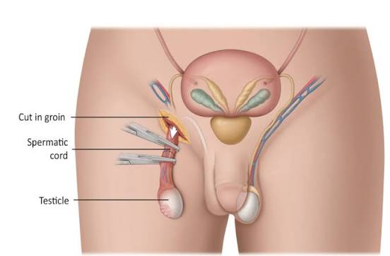 Dr. Avinash Singh Urologist Agra